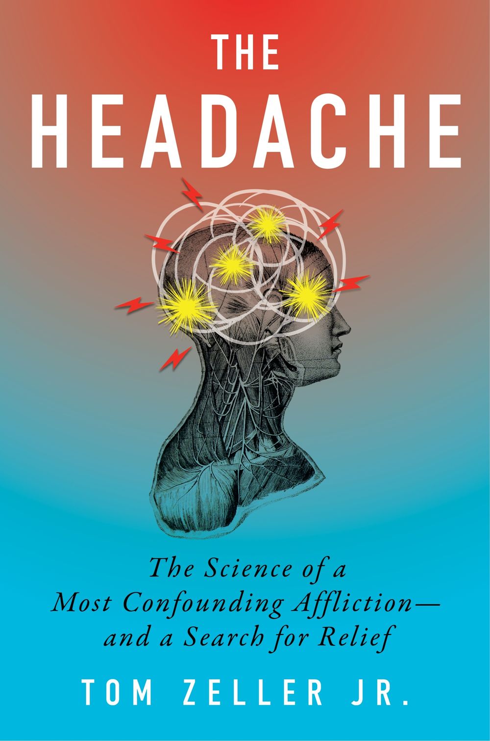 The Headache: The Science of a Most Confounding Affliction-and a Search for Relief