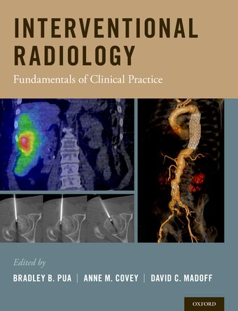Interventional Radiology book cover