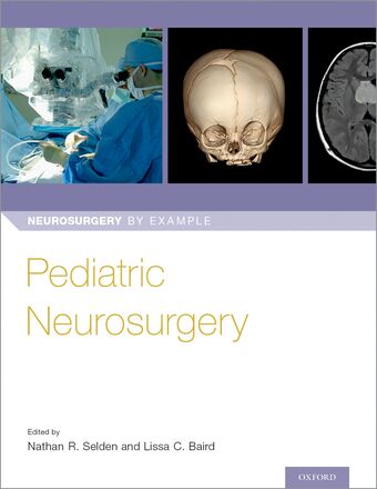 Pediatric Neurosurgery book cover