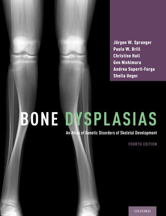 Bone Dysplasias book cover