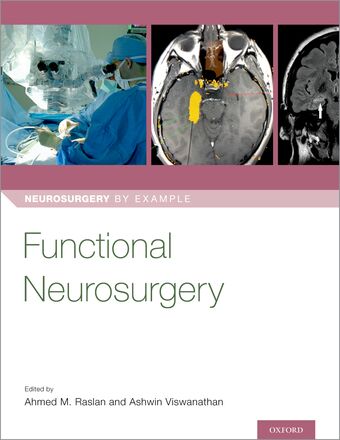 Functional Neurosurgery book cover