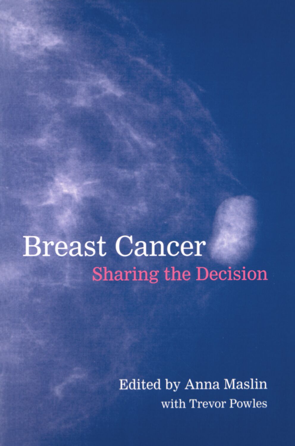 Breast Cancer book cover