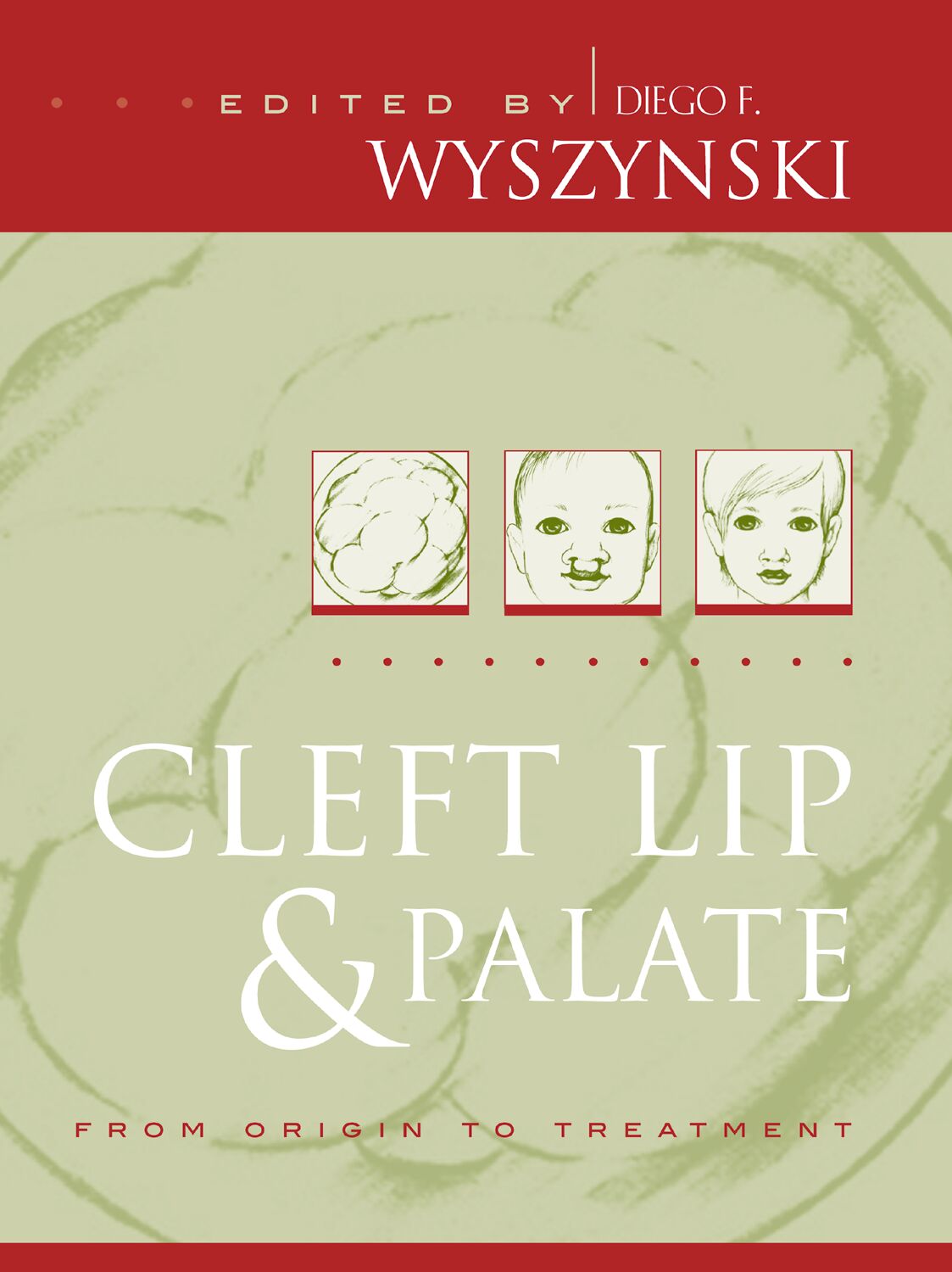 Cleft Lip and Palate book cover