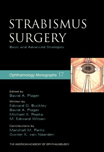 Strabismus Surgery book cover