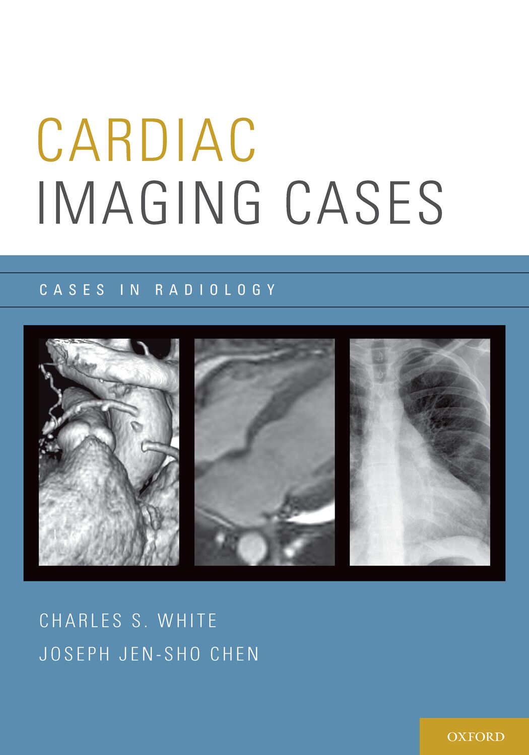 Cardiac Imaging Cases book cover