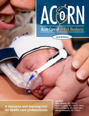 Acute Care of At-Risk Newborns book cover
