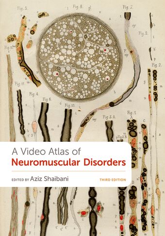 A Video Atlas of Neuromuscular Disorders book cover