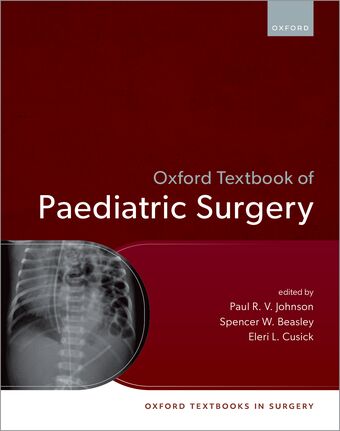 Oxford Textbook of Paediatric Surgery book cover