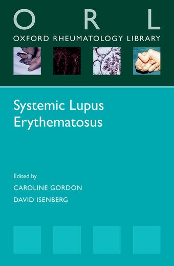 Systemic Lupus Erythematosus book cover