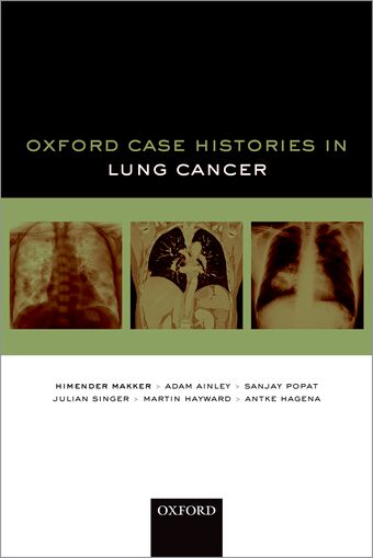 Oxford Case Histories in Lung Cancer book cover