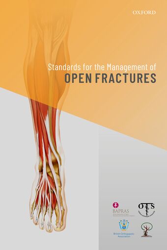 Standards for the Management of Open Fractures book cover