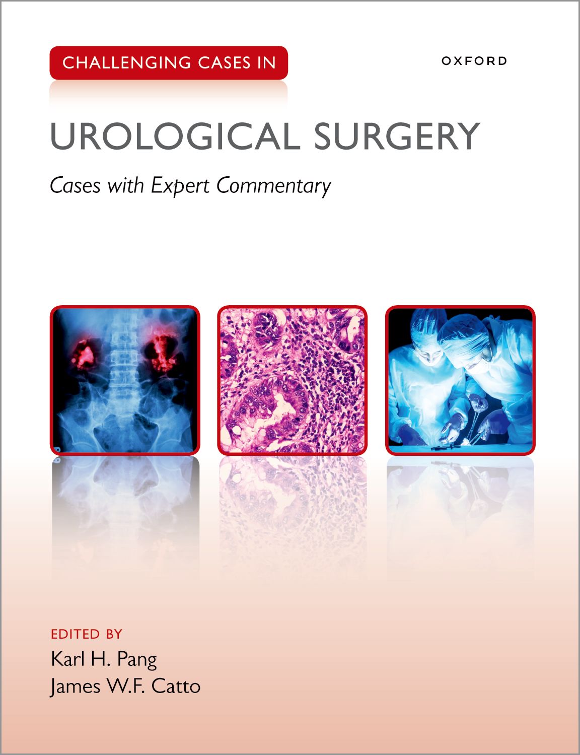 Challenging Cases in Urological Surgery book cover