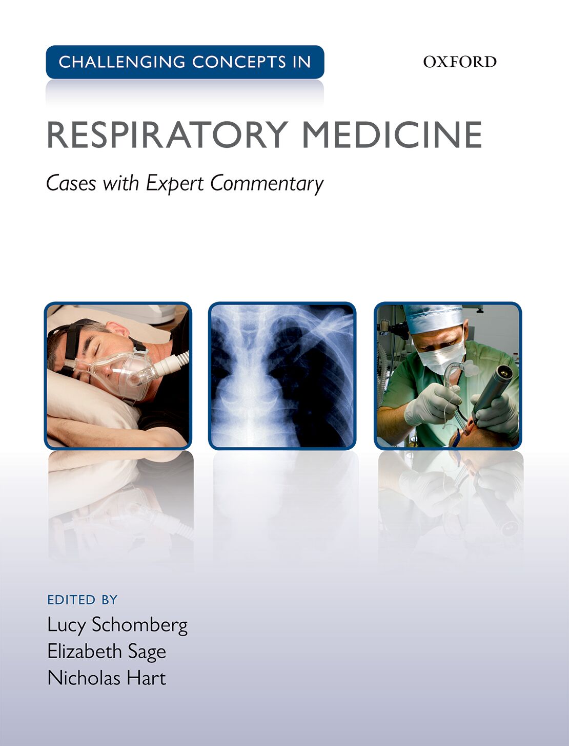 Challenging Concepts in Respiratory Medicine book cover
