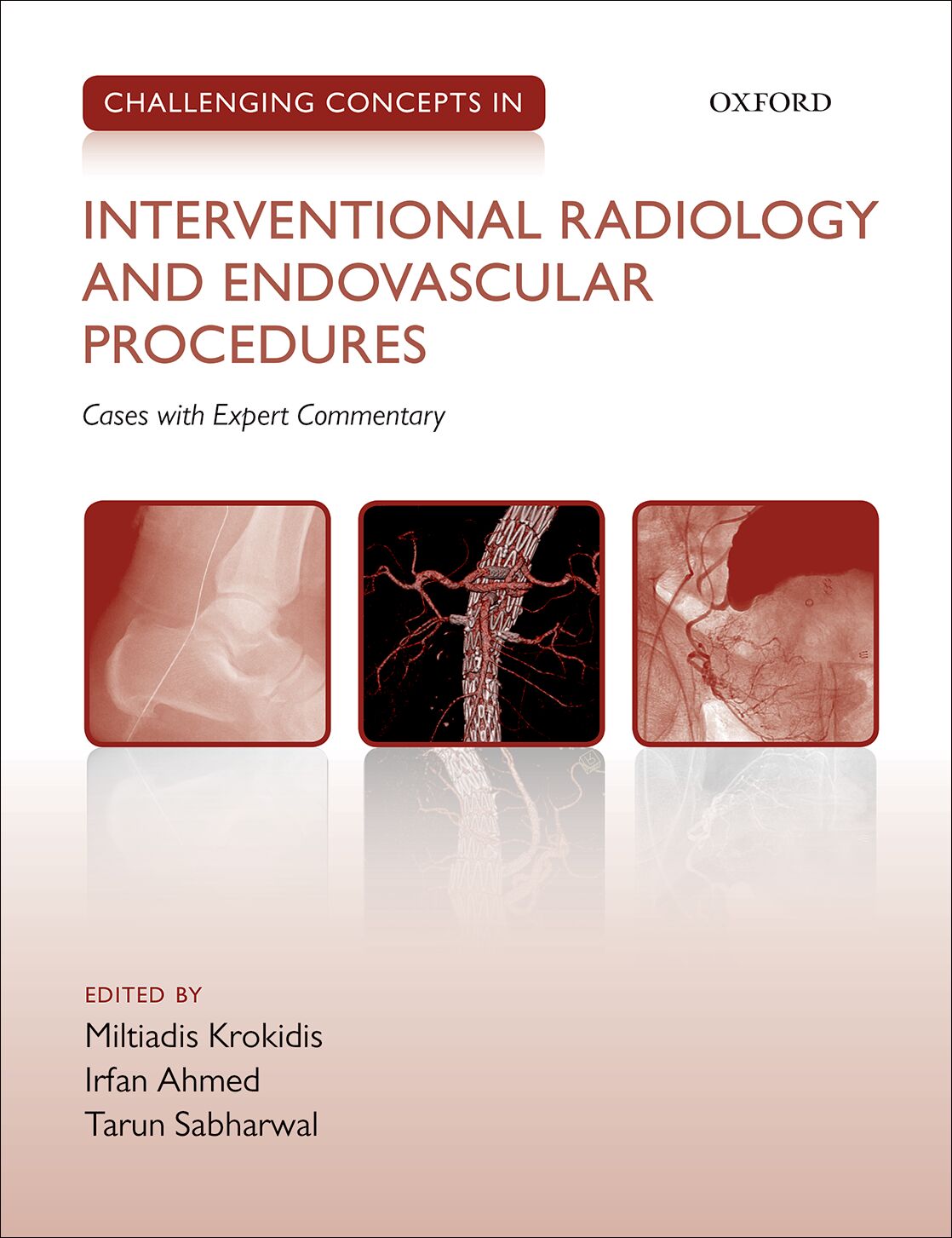 Challenging Concepts in Interventional Radiology book cover
