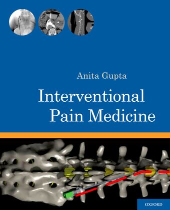 Interventional Pain Medicine book cover