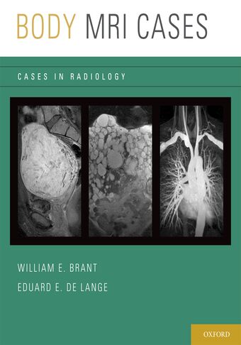 Body MRI Cases book cover