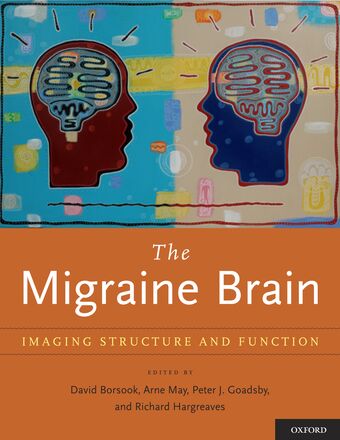 The Migraine Brain book cover