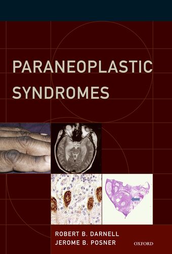 Paraneoplastic Syndromes book cover