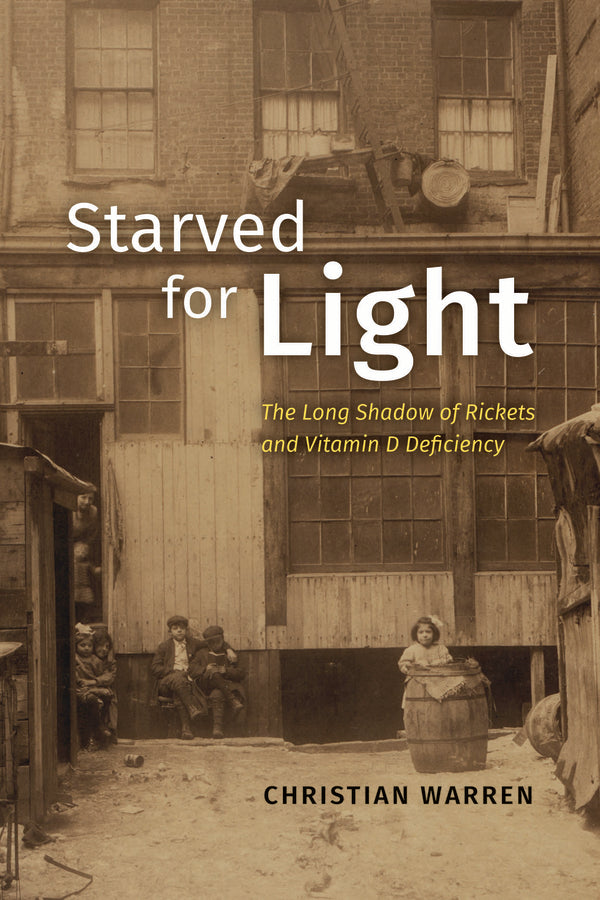 Starved for Light: The Long Shadow of Rickets and Vitamin D Deficiency cover