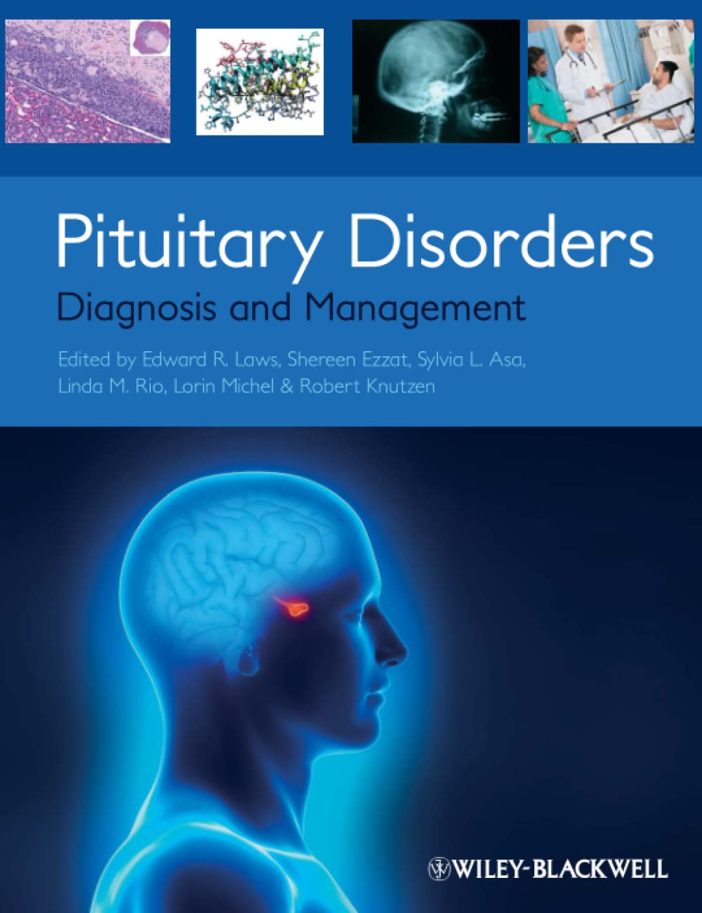 Pituitary Disorders: Diagnosis and Management cover