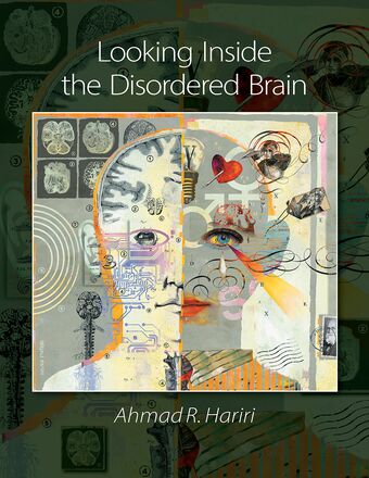 Looking Inside The Disordered Brain book cover