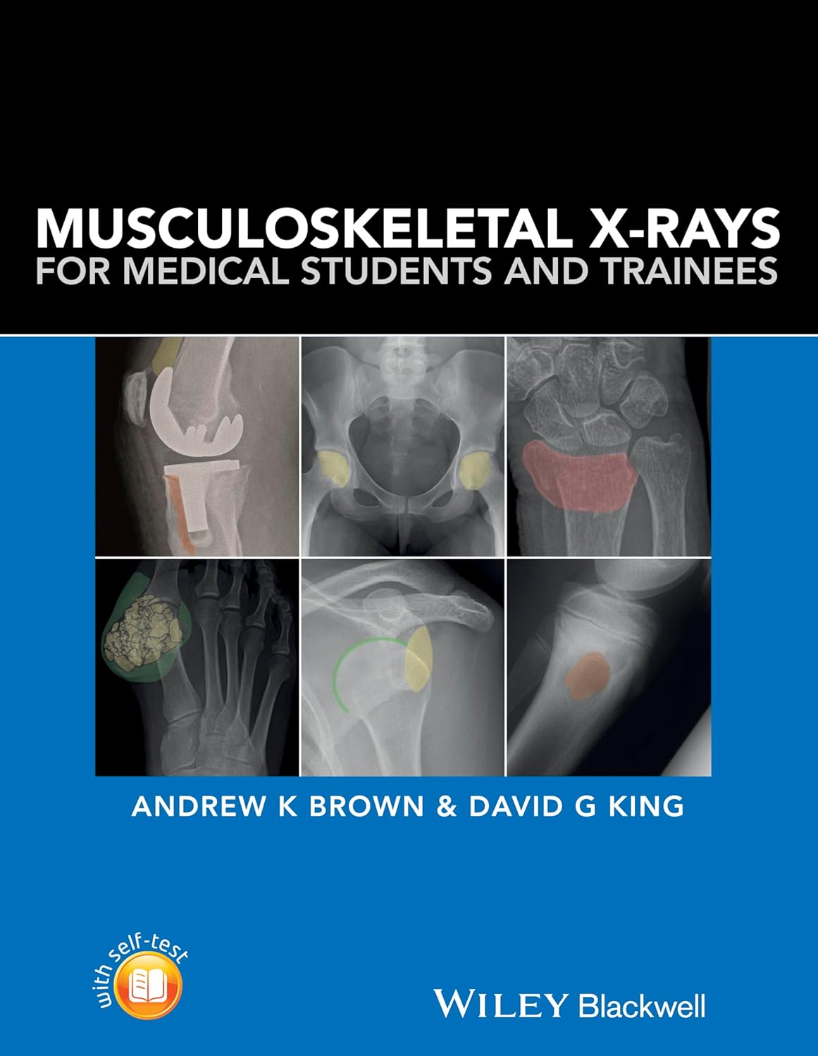 Musculoskeletal X-Rays for Medical Students and Trainees cover