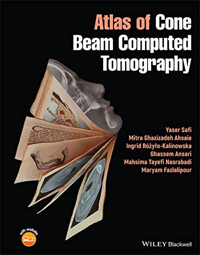 Atlas of Cone Beam Computed Tomography cover