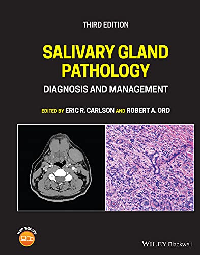 Salivary Gland Pathology: Diagnosis and Management cover