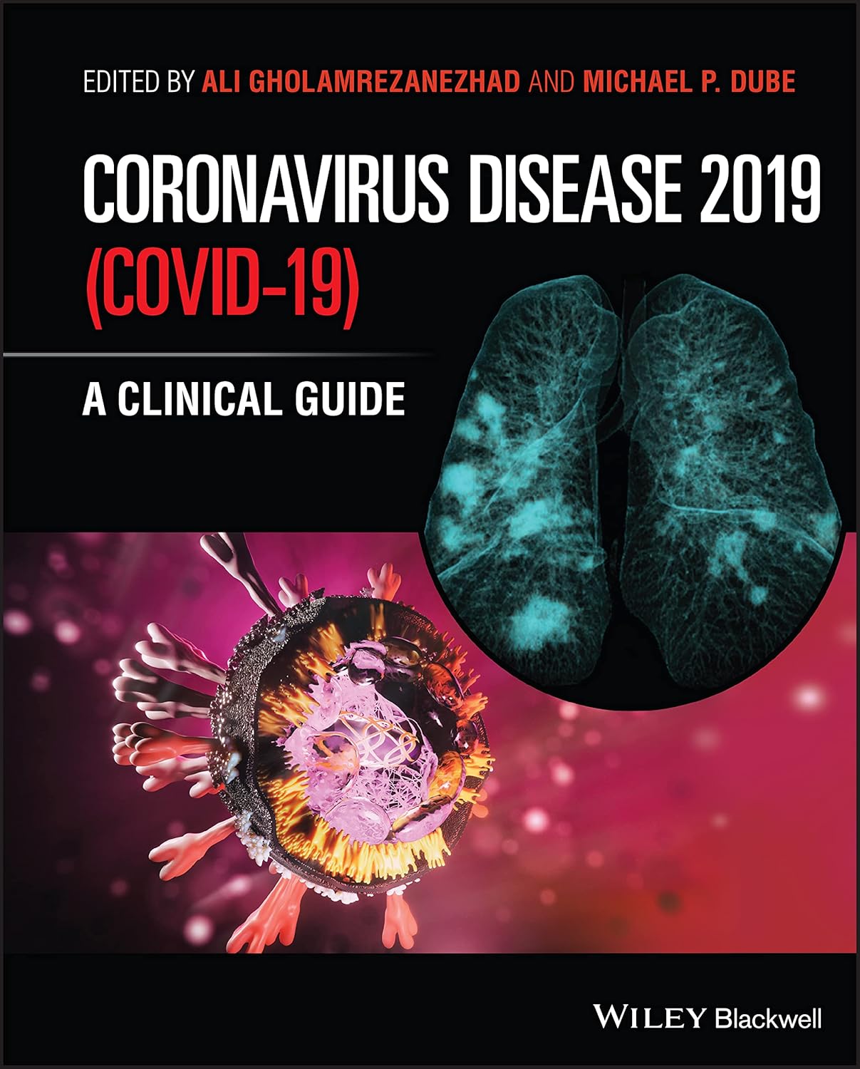 Coronavirus Disease 2019 (Covid-19): A Clinical Guide cover