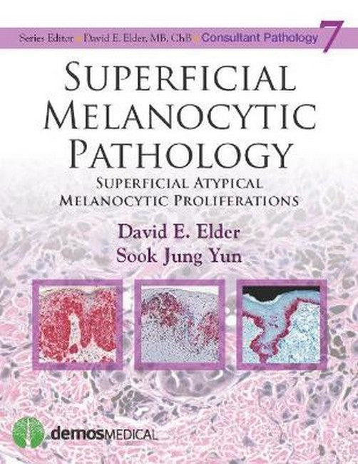 Superficial Melanocytic Pathology: Superficial Atypical Melanocytic Proliferations