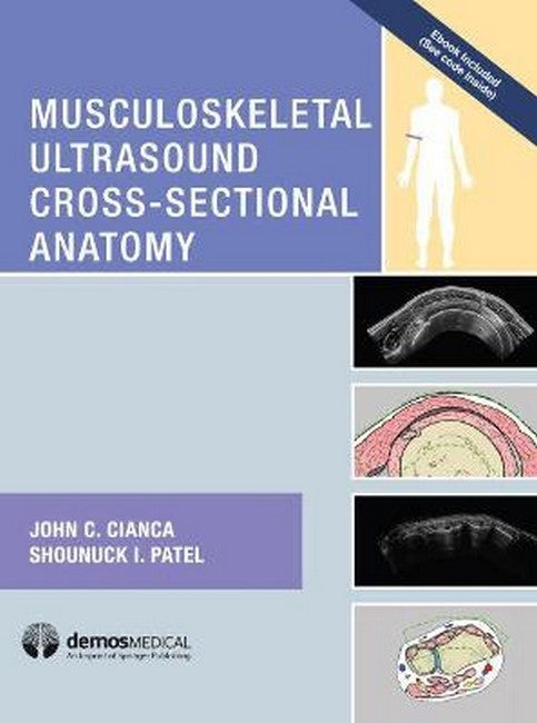 Musculoskeletal Ultrasound Cross-Sectional Anatomy cover