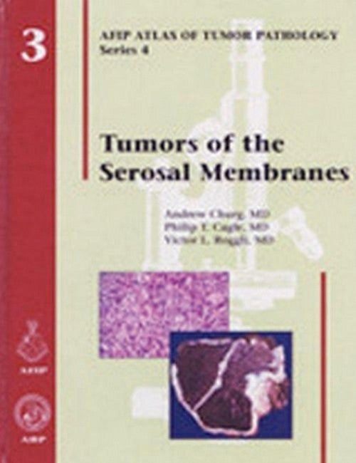 Tumors of the Serosal Membranes cover