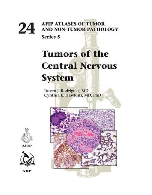 Tumors of the Central Nervous System cover
