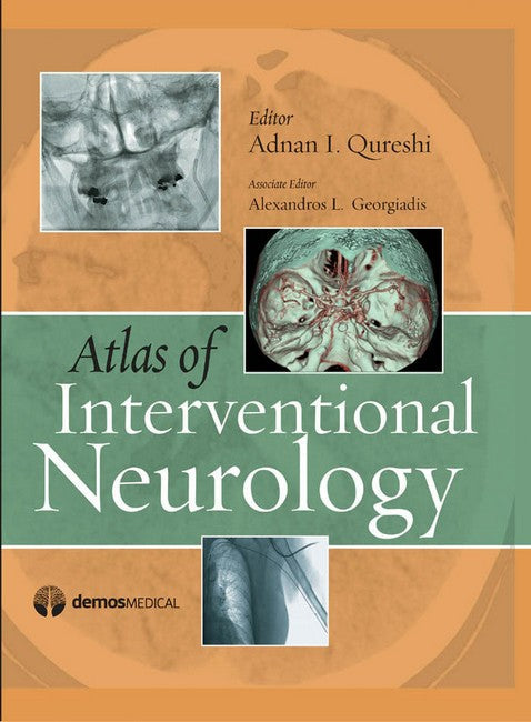 Atlas of Interventional Neurology cover