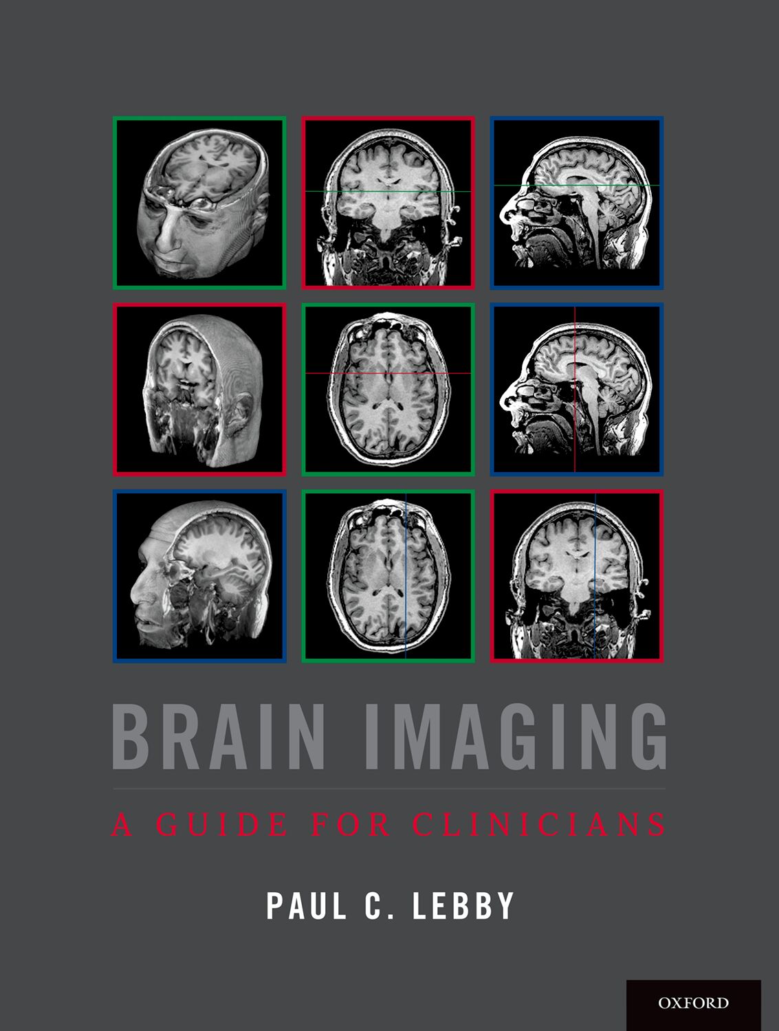 Brain Imaging book cover