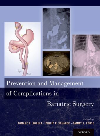 Prevention and Management of Complications in Bariatric Surgery book cover