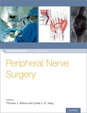 Peripheral Nerve Surgery book cover
