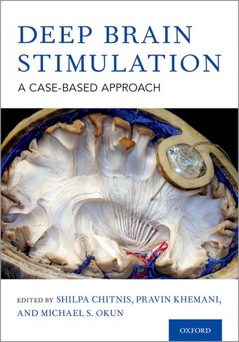 Deep Brain Stimulation A Case-based Approach book cover