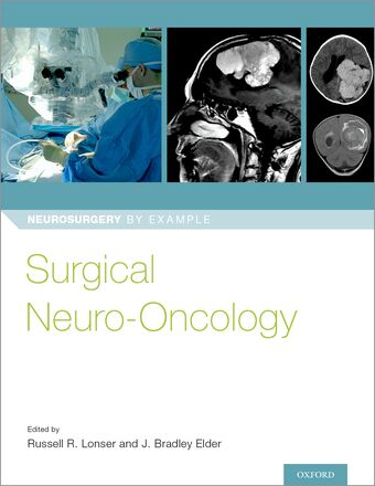Surgical Neuro-Oncology book cover