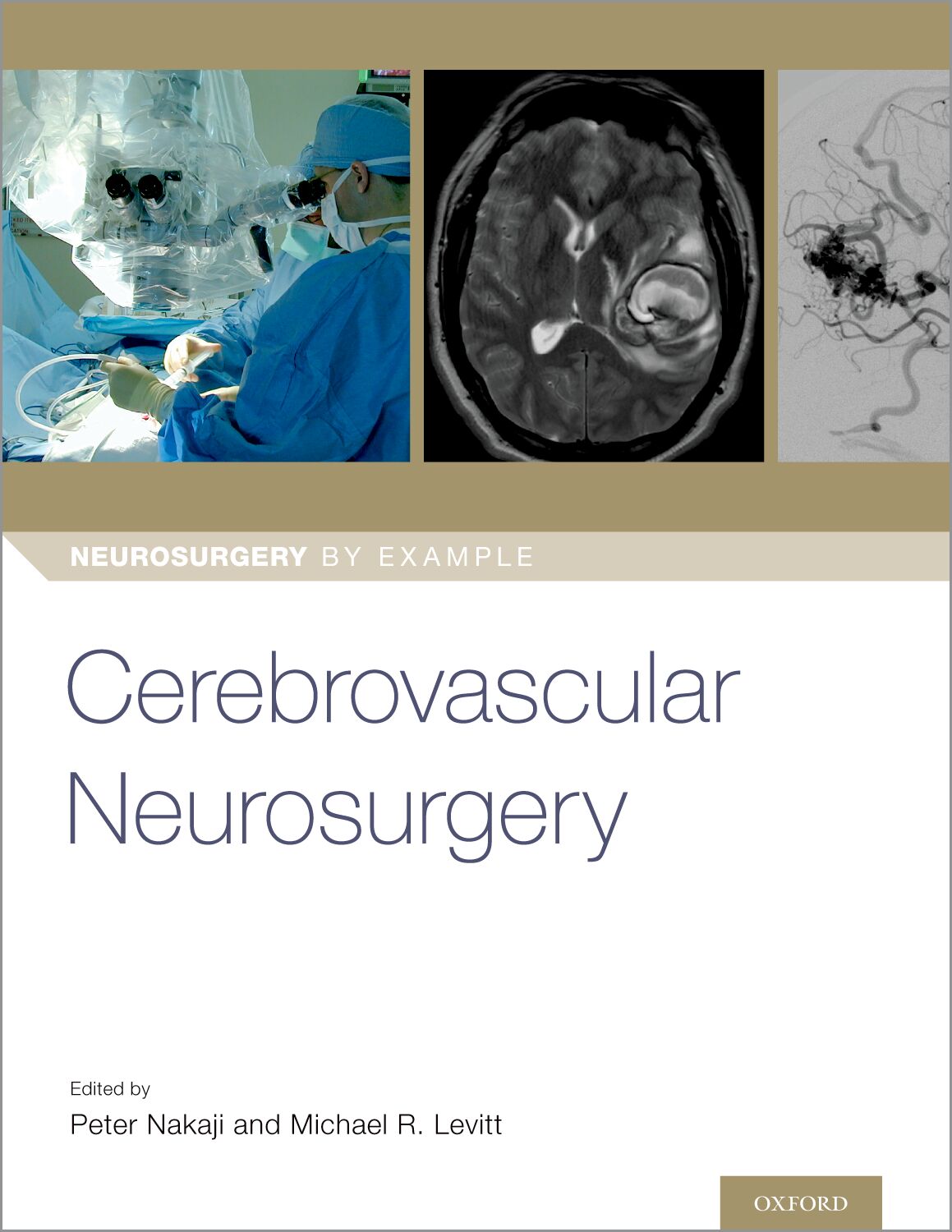 Cerebrovascular Neurosurgery book cover