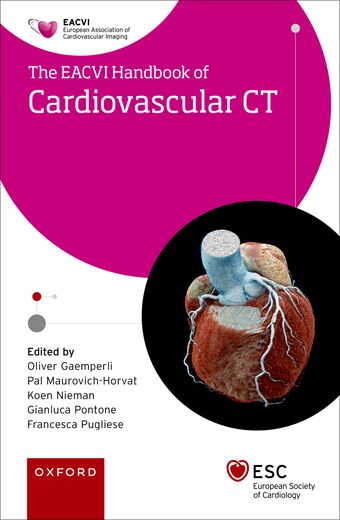 EACVI Handbook of Cardiovascular CT book cover