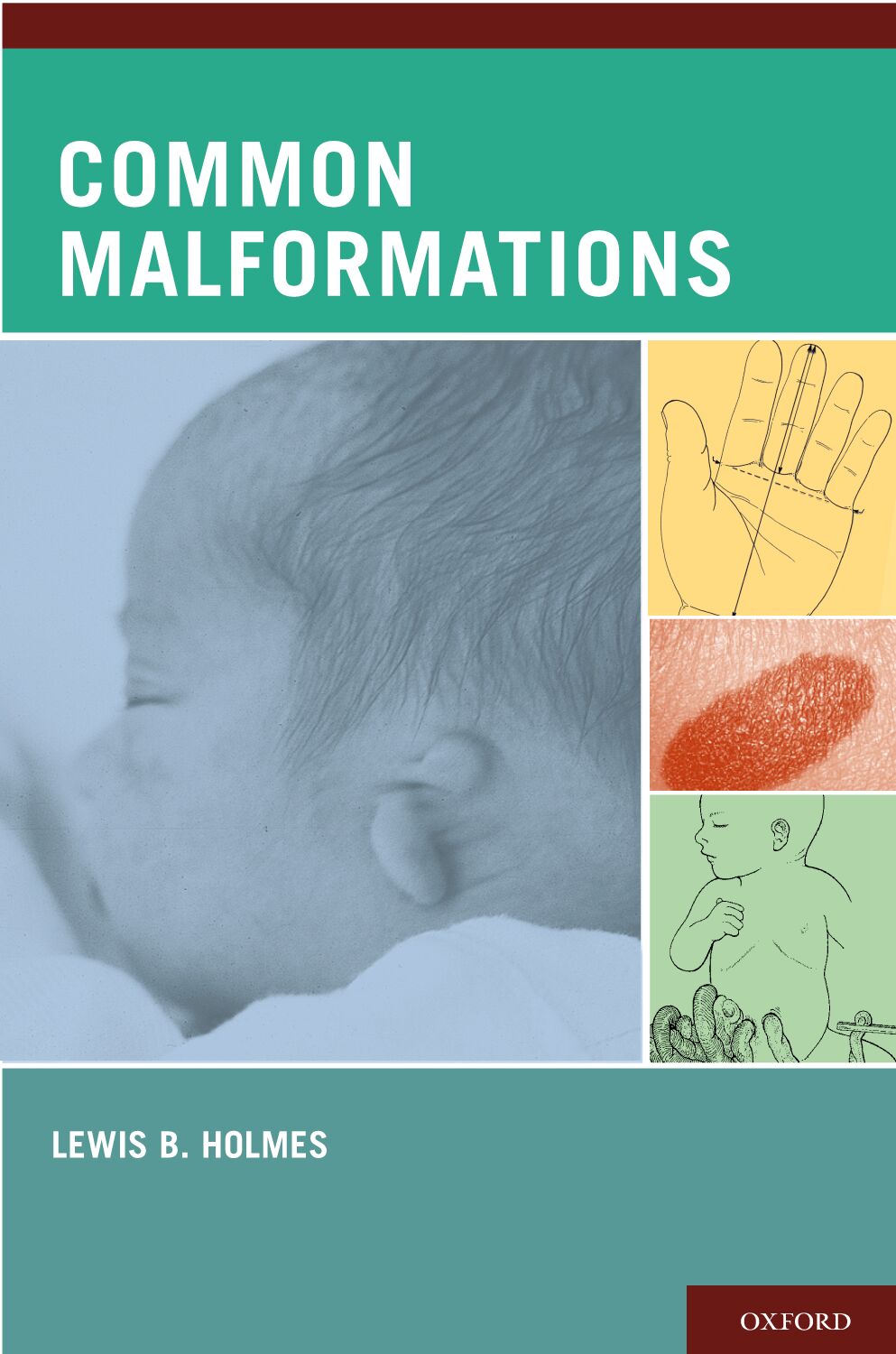 Common Malformations book cover