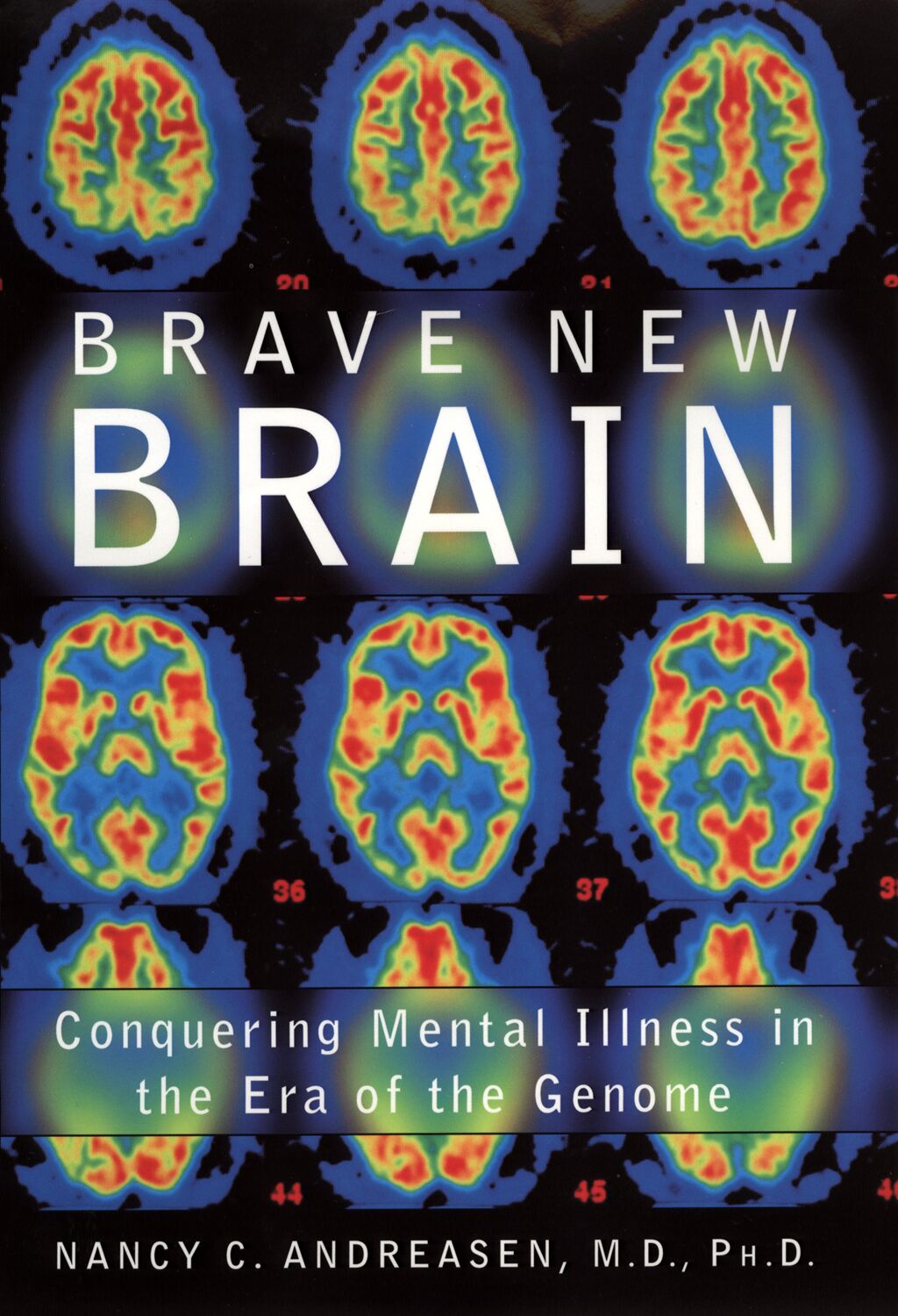 Brave New Brain book cover