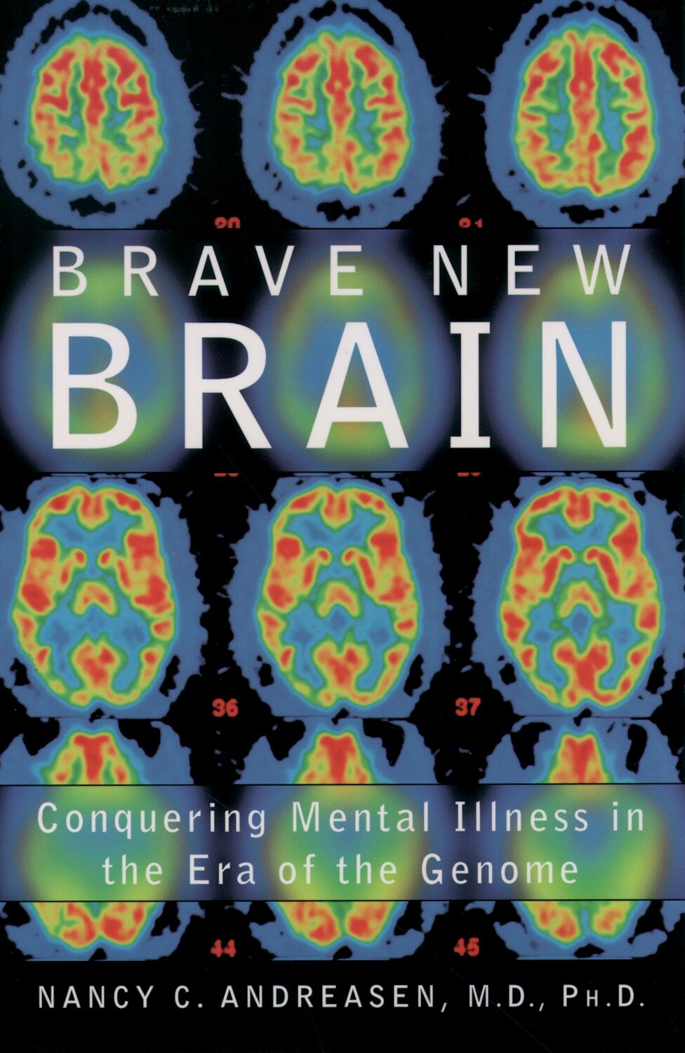 Brave New Brain book cover