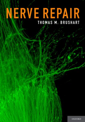 Nerve Repair book cover
