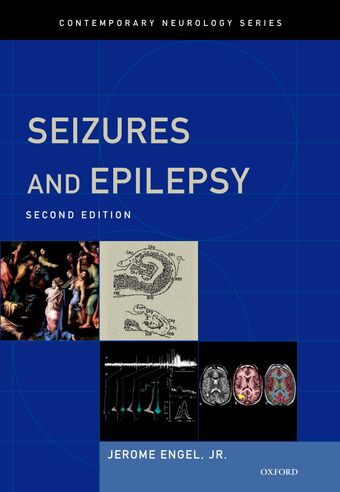 Seizures and Epilepsy book cover
