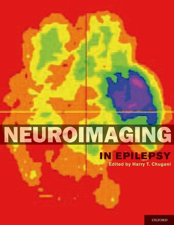 Neuroimaging in Epilepsy book cover