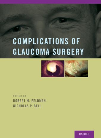 Complications of Glaucoma Surgery book cover
