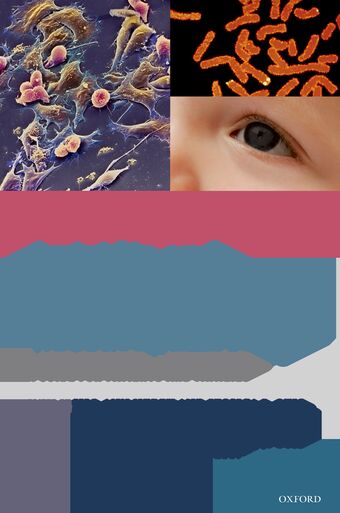 Aniridia and WAGR Syndrome book cover