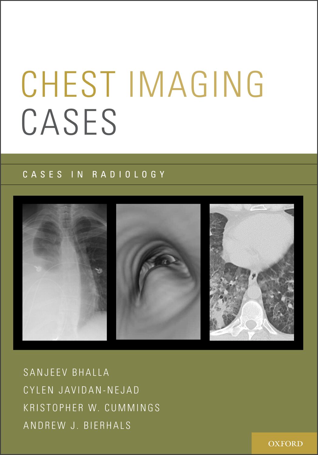 Chest Imaging Cases book cover